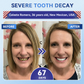 rivoneed® 🦷 Tideglusib Fast‑Dissolving Tooth & Gum Repair Oral Strips ✨