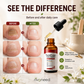 Nail Repair Essence for Damaged Nails