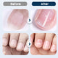 💅 Fix Damaged Nails Fast ✨ Limited Deal